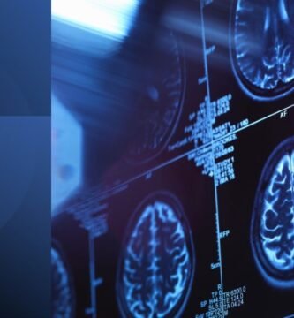 Brain scan image symbolizing the subconscious mind’s influence in powerful communication and emotional connection.